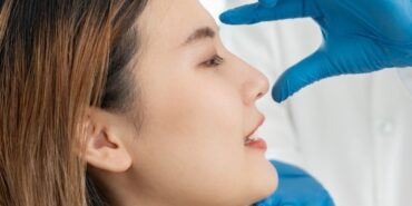 Kayseri burun estetiği (2)