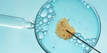 Tüp bebek merkezi (2)