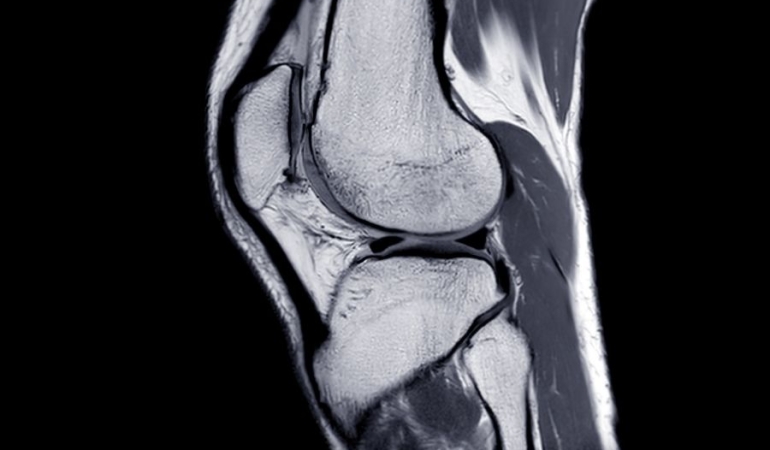Eklem ve Kas Sağlığında Önemli Sorunlar